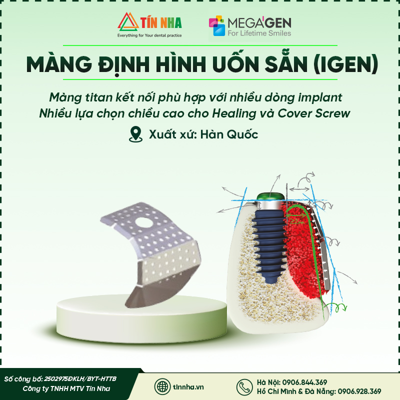 MÀNG ĐỊNH HÌNH UỐN SẴN I-GEN